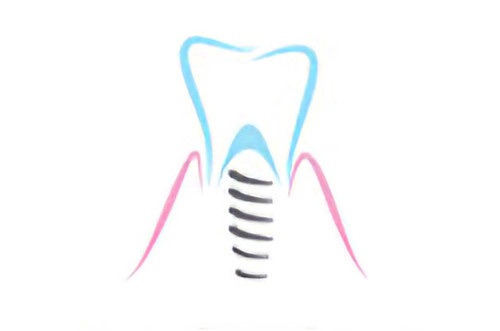 soins dentaires Soumoulou implants dentaires